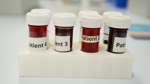 A selection of pots in a tray labelled patient 1. 2 and 3
